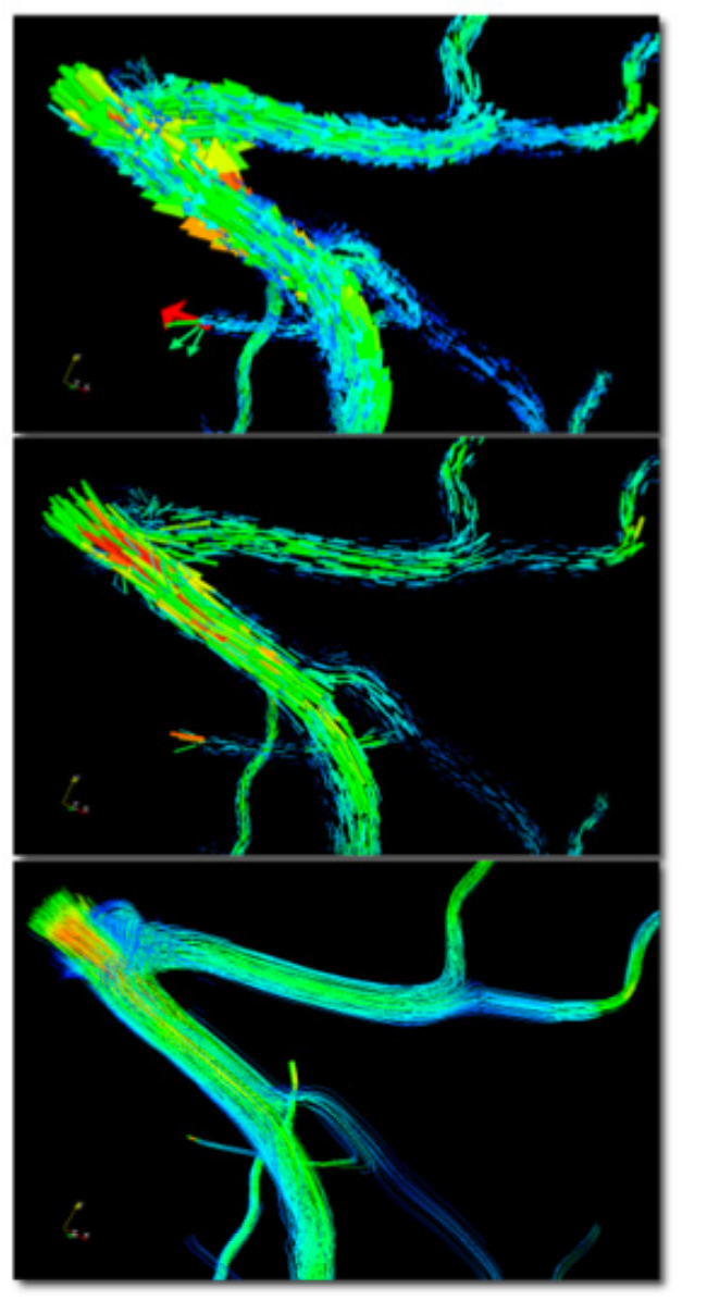 Multidimensional visualization of hemodynamic data