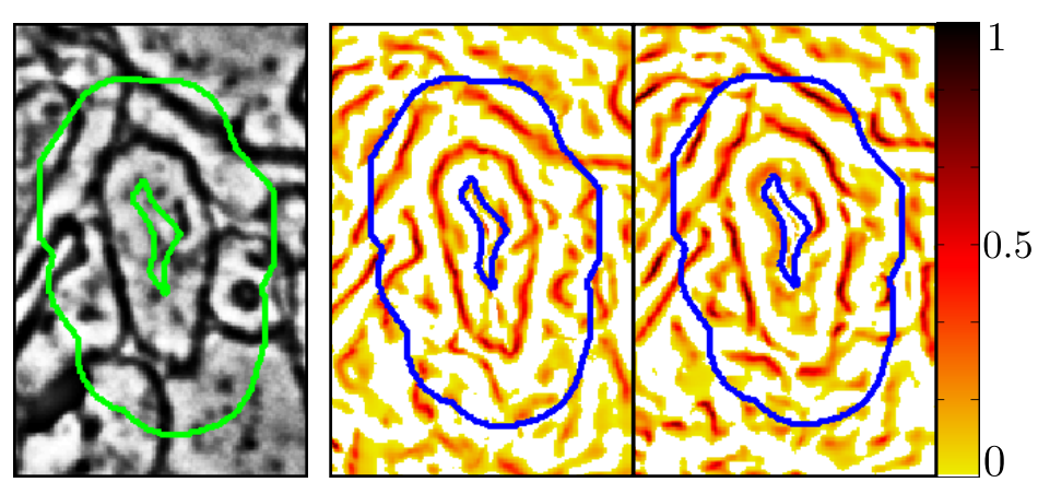 Multiphase Geometric Couplings for the Segmentation of Neural Processes