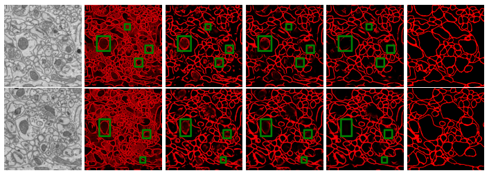 Detection of Neuron Membranes in Electron Microscopy Images using Multi-scale Context and Radon-like Features