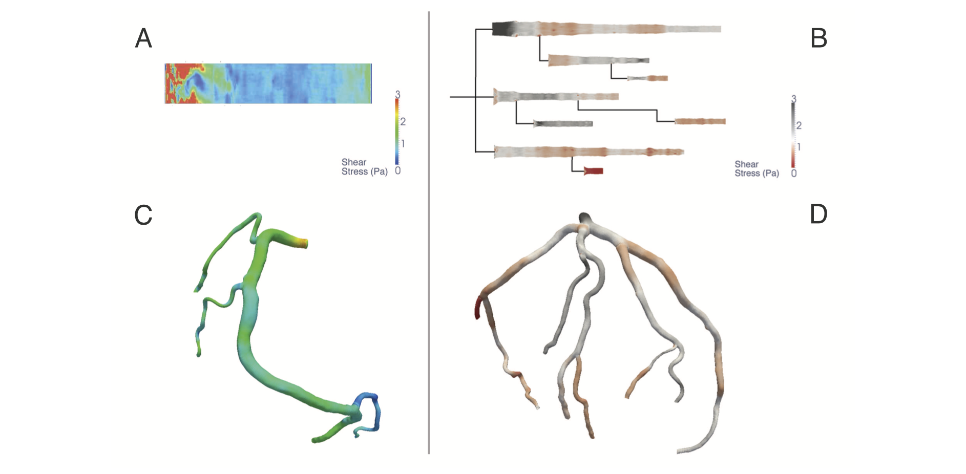 Evaluation of Artery Visualizations for Heart Disease Diagnosis