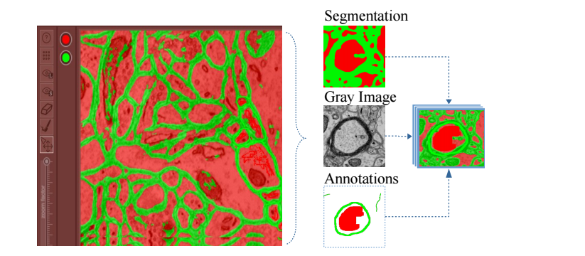 Icon: An Interactive Approach to Train Deep Neural Networks for Segmentation of Neuronal Structures