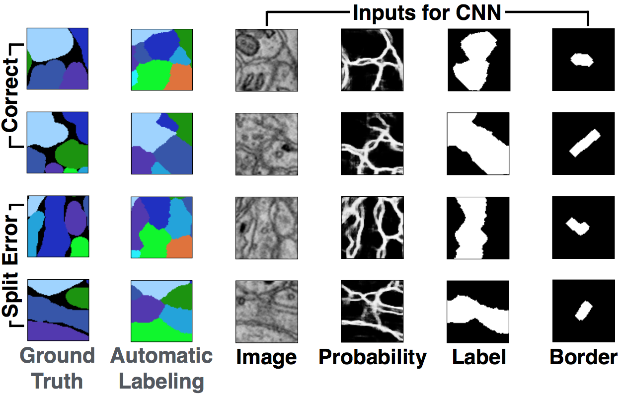 Guided Proofreading of Automatic Segmentations for Connectomics