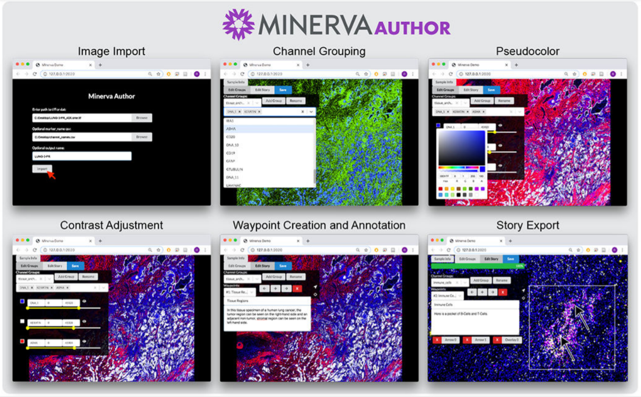 Minerva: a light-weight, narrative image browser for multiplexed tissue images