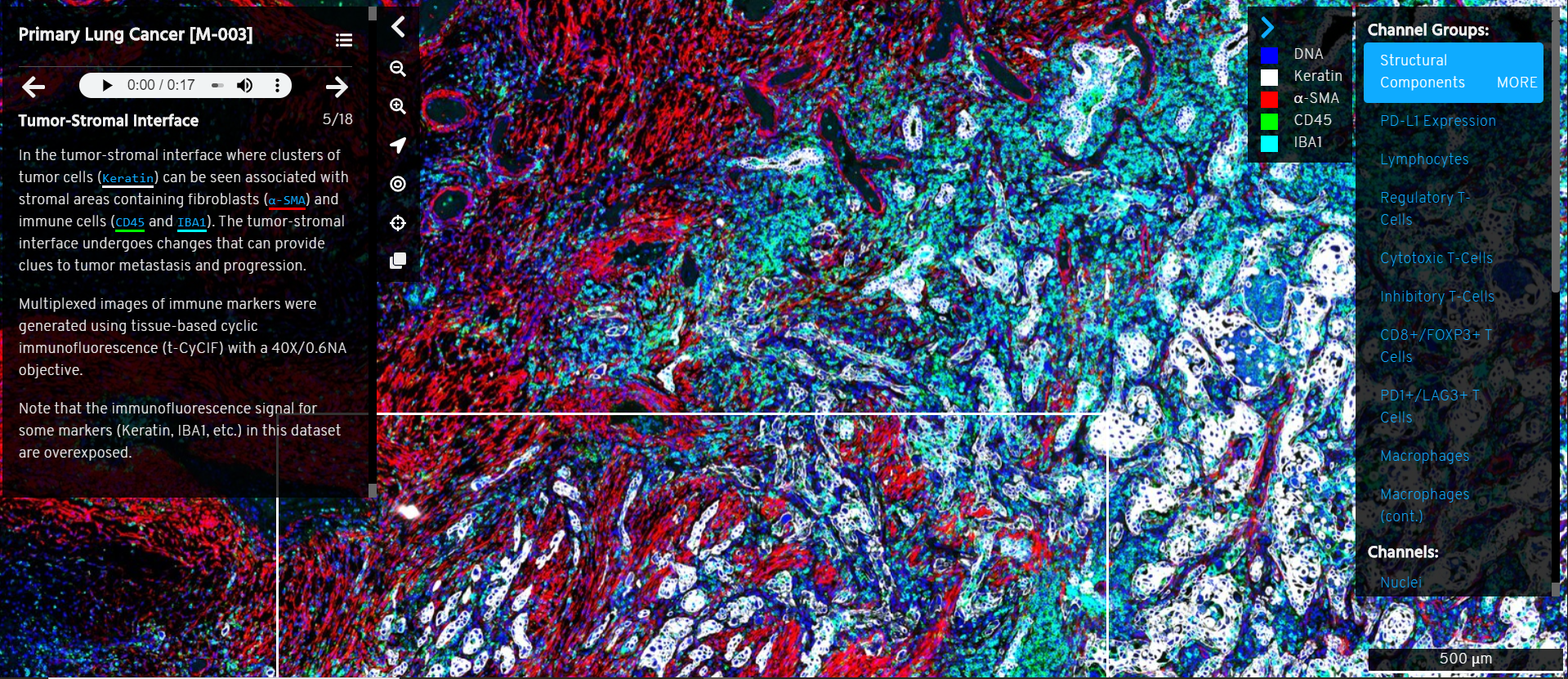 Narrative Online Guides for the Interpretation of Digital-Pathology Images and Tissue-Atlas Data