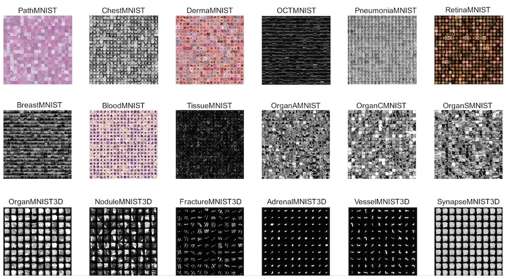 MedMNIST v2: A Large-Scale Lightweight Benchmark for 2D and 3D Biomedical Image Classification