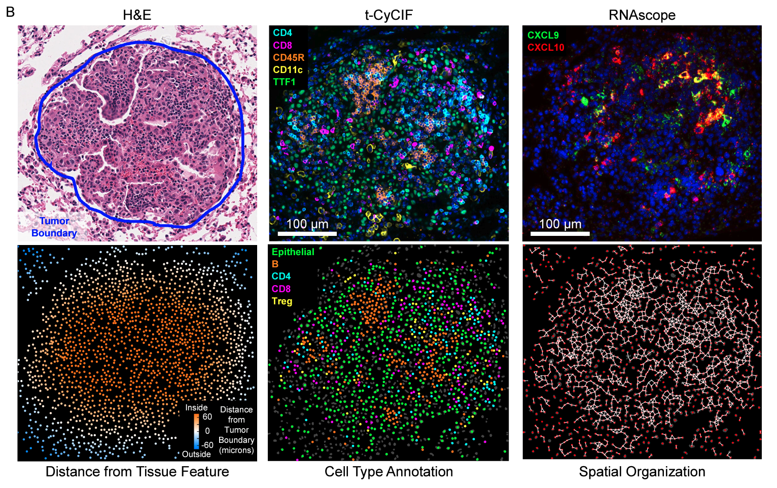 Lymphocyte networks are dynamic cellular communities in the immunoregulatory landscape of lung adenocarcinoma