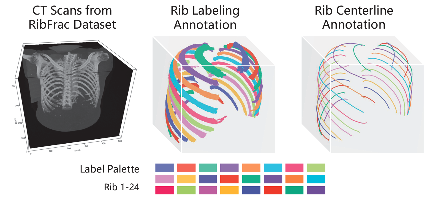 RibSeg v2: A Large-scale Benchmark for Rib Labeling and Anatomical Centerline Extraction