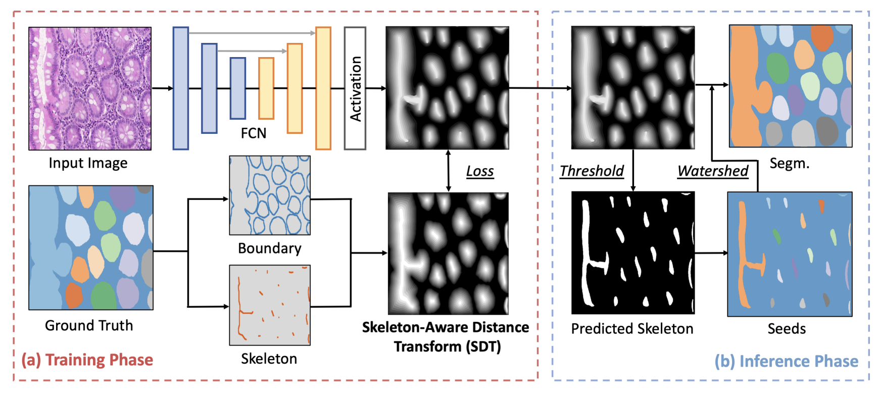 Structure-Preserving Instance Segmentation via Skeleton-Aware Distance Transform