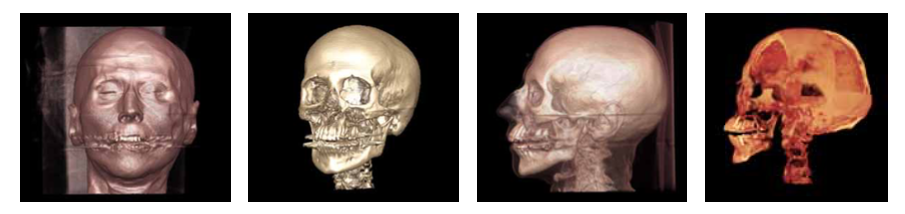 Real-time volume visualization with volumepro