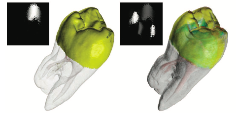 The Transfer Function Bake-Off