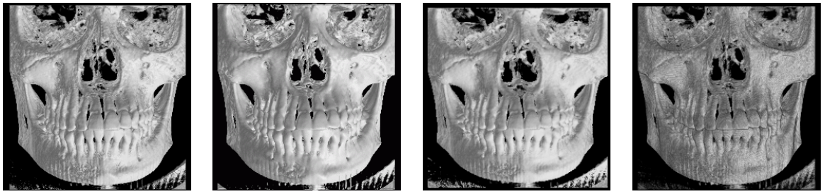 Volume Visualization and Volume Rendering Techniques