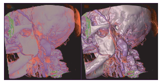 Hardware-Accelerated Volume Rendering