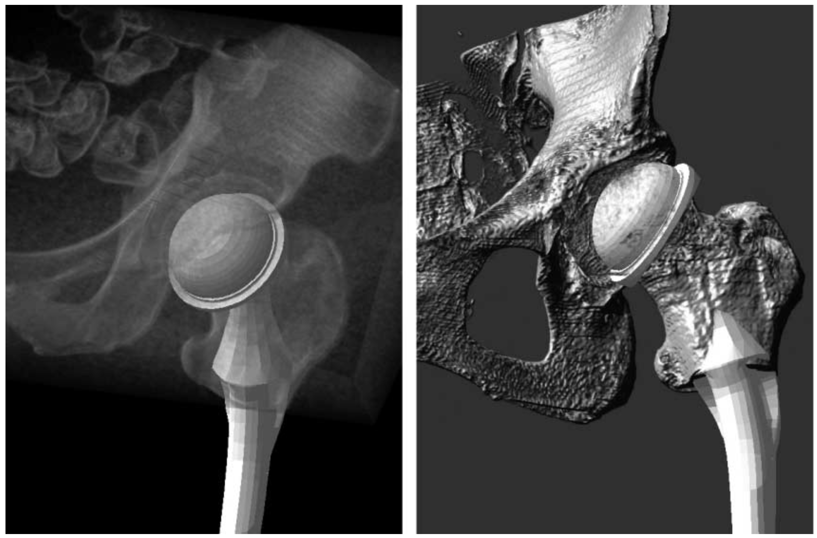 Moderne Volumenvisualisierung (Modern Volume Visualization)