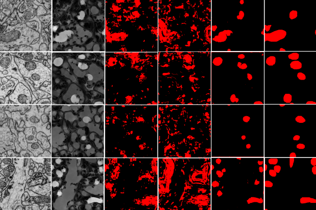 Radon-Like Features and their Application to Connectomics