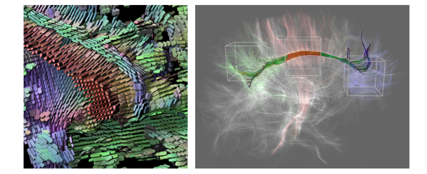 Visualization in Connectomics