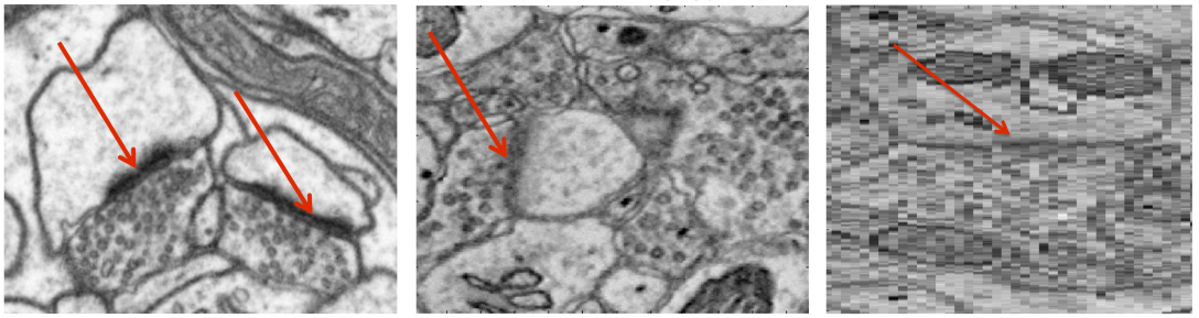 VESICLE: Volumetric Evaluation of Synaptic Interfaces using Computer Vision at Large Scale