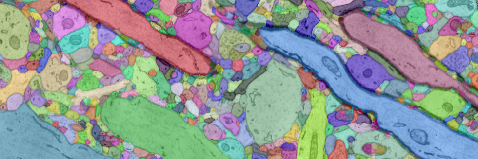 Automatic Neural Reconstruction from Petavoxel of Electron Microscopy Data