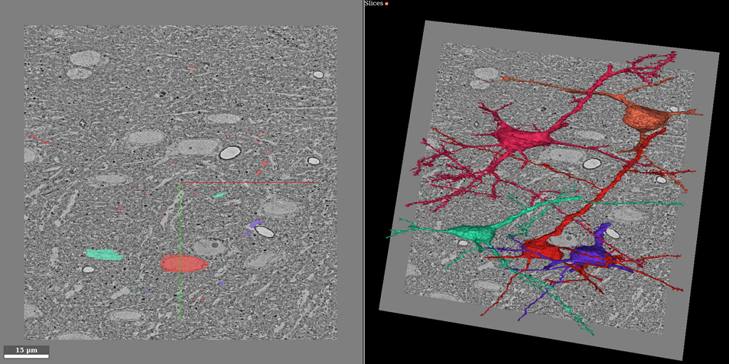 Anisotropic EM Segmentation by 3D Affinity Learning and Agglomeration