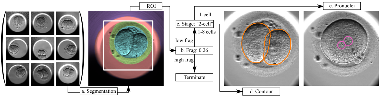 Automated Measurements of Key Morphological Features of Human Embryos for IVF