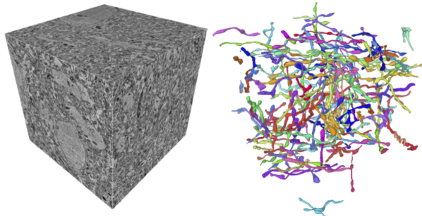 MitoEM Dataset: Large-scale 3D Mitochondria Instance Segmentation from EM Images