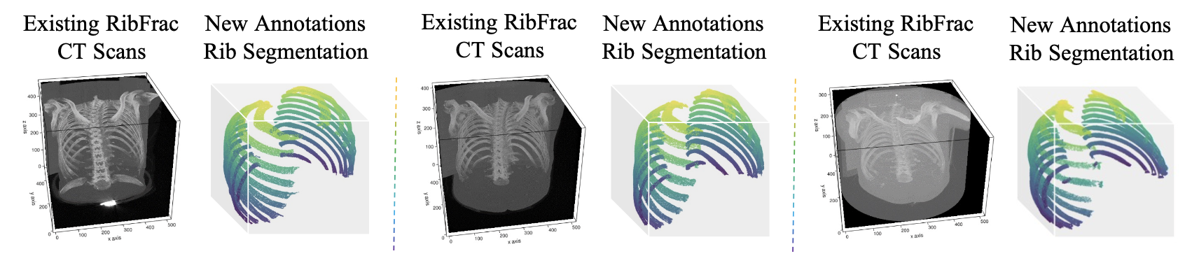 RibSeg Dataset and Strong Point Cloud Baselines for Rib Segmentation from CT Scans