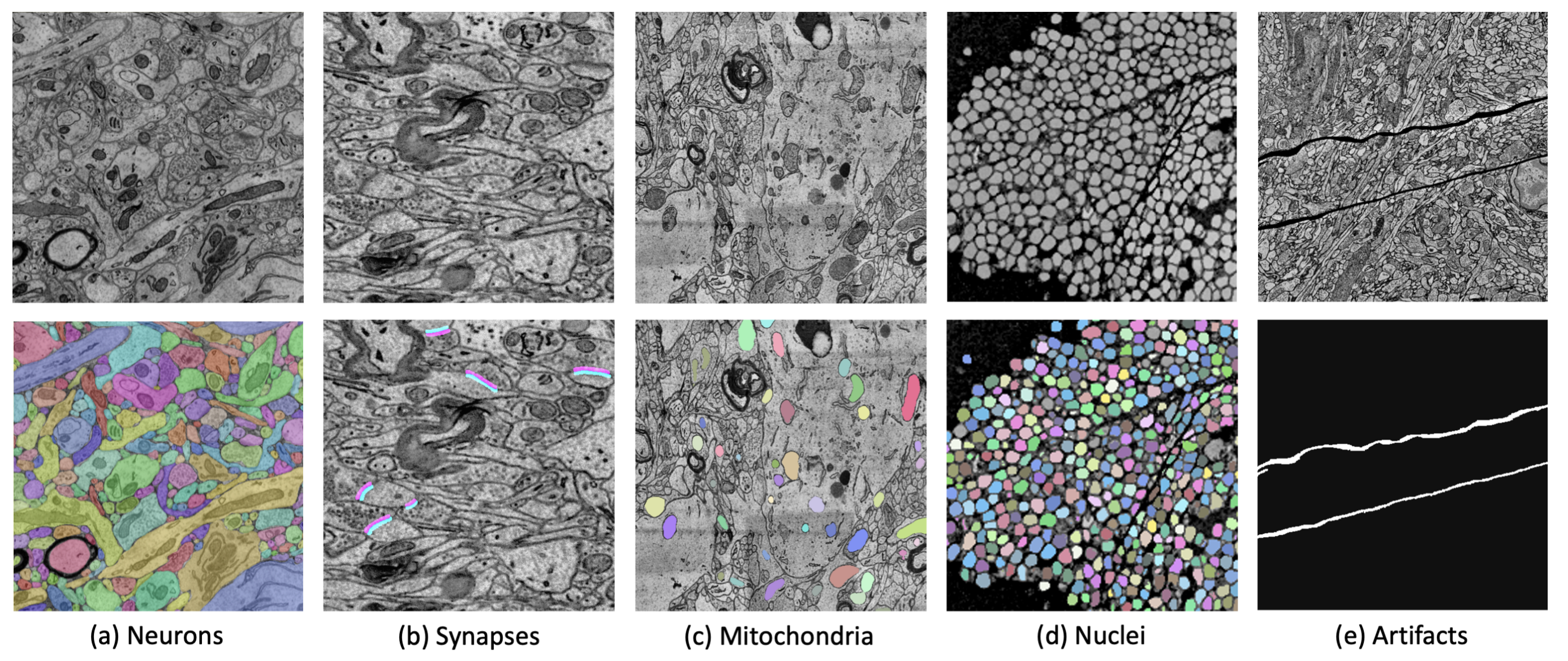 PyTorch Connectomics: A Scalable and Flexible Segmentation Framework for EM Connectomics