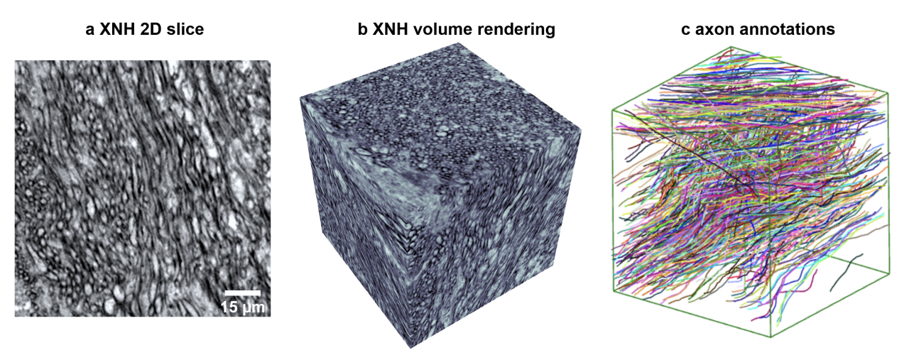 Current Progress and Challenges in Large-scale3D Mitochondria Instance Segmentation
