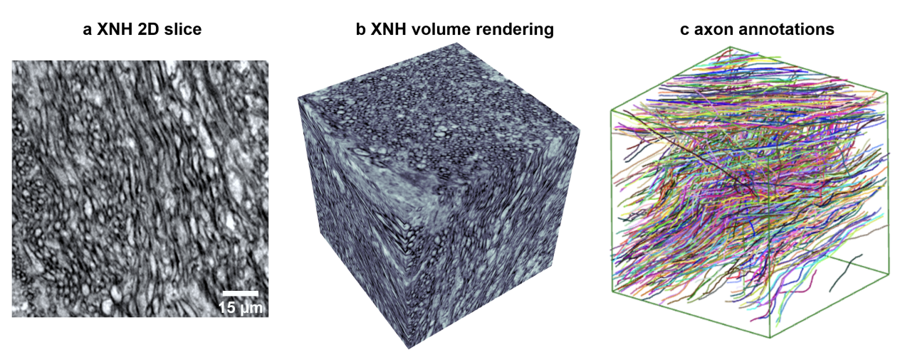 The XPRESS Challenge: Xray Projectomic Reconstruction -- Extracting Segmentation with Skeletons