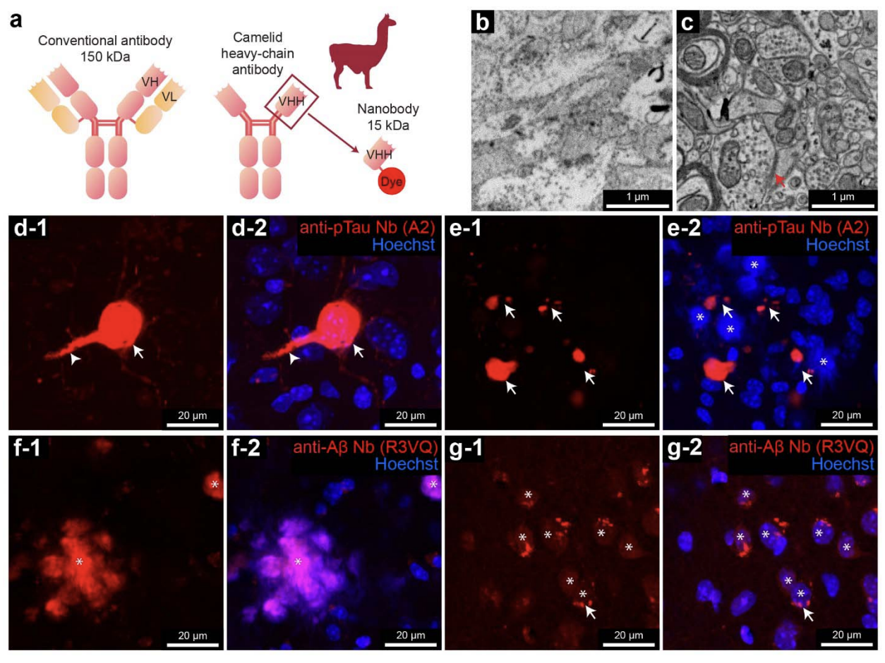 A large-scale volumetric correlated light and electron microscopy study localizes Alzheimer's disease-related molecules in the hippocampus