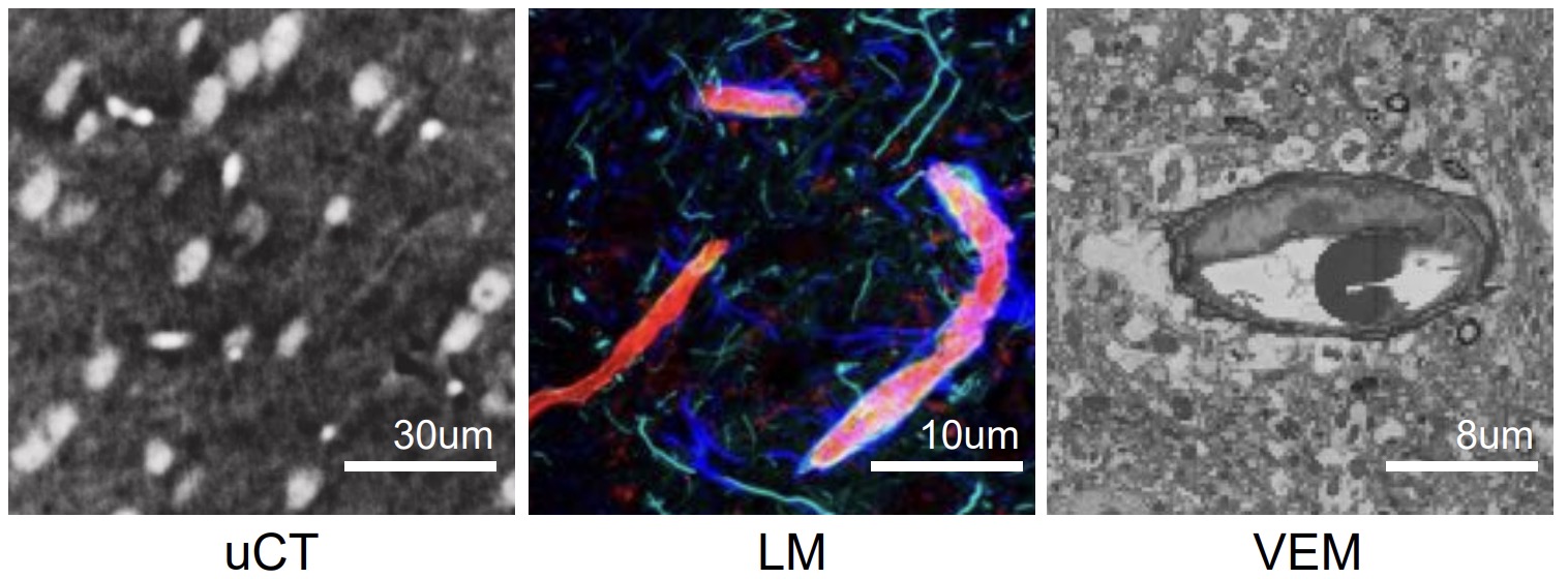 TriSAM: Tri-Plane SAM for zero-shot cortical blood vessel segmentation in VEM images